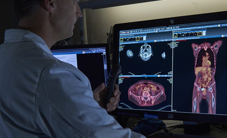 Le flux de travail en radiologie : De l'acquisition de l'image au rapport de diagnostic